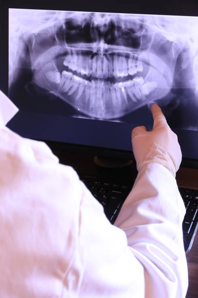 Best Broken or Chipped Tooth Repair in Spring Hill, KS