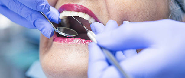 Best Emergency Wisdom Tooth Extraction in Spring Hill, KS